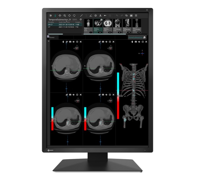 Eizo MX217- monitor medyczny, stomatologiczny