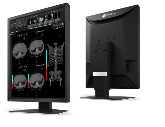 Eizo MX217- monitor medyczny, stomatologiczny - obrazek 2