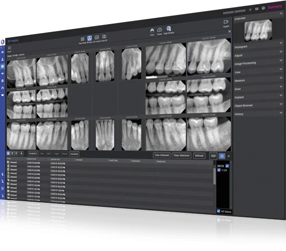Planmeca ProSensor ®HD - system radiowizjografii cyfrowej - rozmiar 1 - obrazek 2